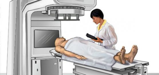 Vấn đề ở miệng khi điều trị ung thư