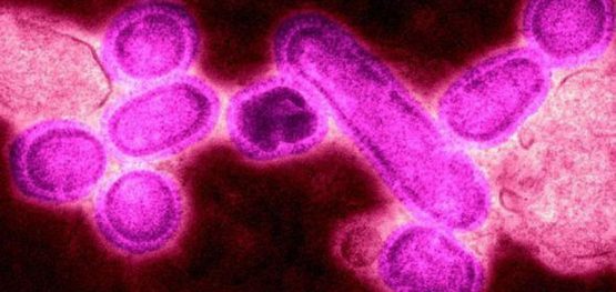 f84ef05c064f8b48cc5f663cb54b53cf