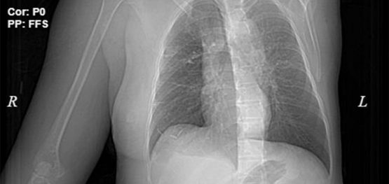 f3e50b0cfd3fa4fe6792fd7b3f8d12fa