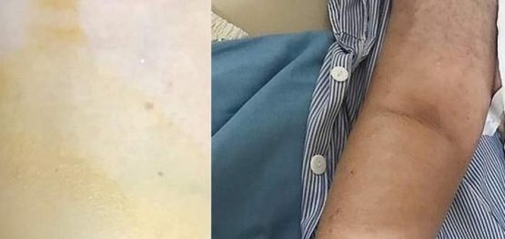 20e50beae5fae493b6fa83573dd450ce