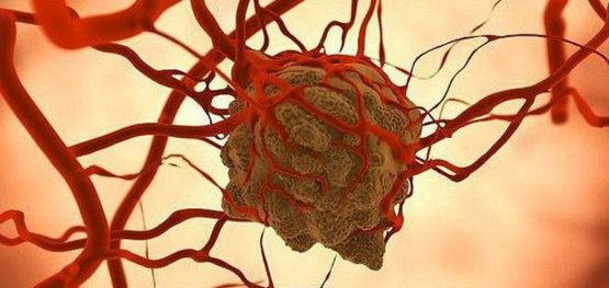 ad121d3f7bf6d80ab8623ad1c3f4a55f