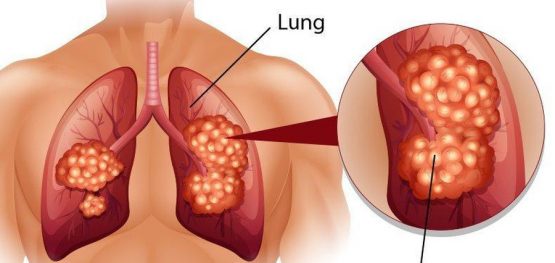 ede7a485e994ae9dd26b50d198a502e2