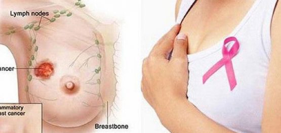 0fe647d8b02623deadadd5bdf3e04855